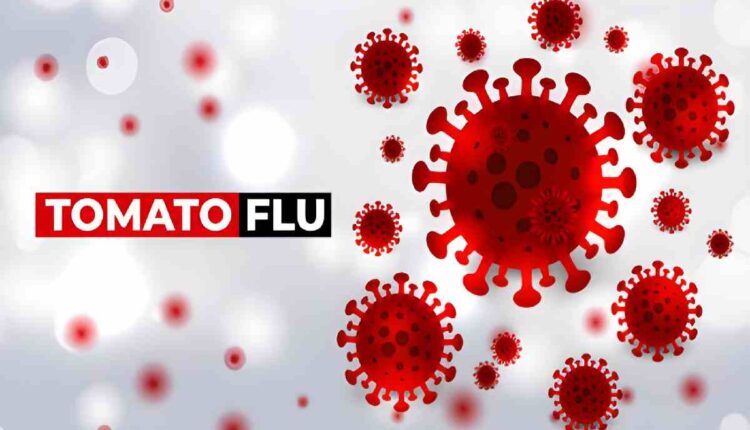 Tomato Flu Symptoms