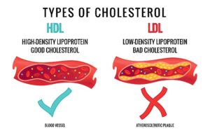 How to Lower Cholesterol Naturally