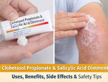 clobetasol propionate and salicylic acid ointment