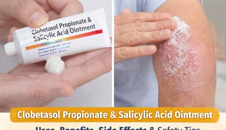 clobetasol propionate and salicylic acid ointment