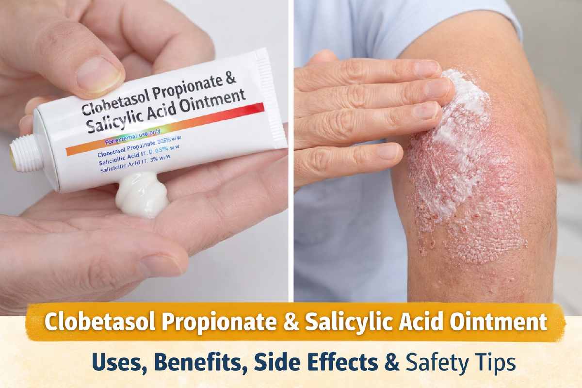 clobetasol propionate and salicylic acid ointment