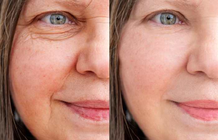 Why Skin Looks Different When the Seasons Shift